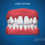 sna_Brekety