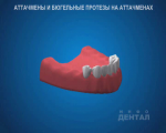 sna_Byugel_na_attachmenakh