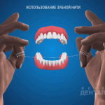 sna_Flossing