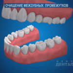 sna_Gigiena_mezhzubnykh_promezhutkov
