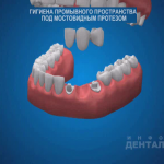 sna_Gigiena_mostovidnykh_protezov