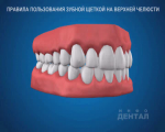 sna_Gigiena_na_verkhney_chelyusti