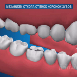 sna_Mekhanizm_otloma_stenki
