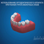 sna_Mestokhranitel