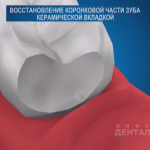 sna_Nepryamaya_restavratsia
