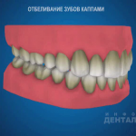 sna_Otbelivanie_domashnee