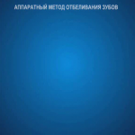 sna_Otbelivanie_ofisnoe