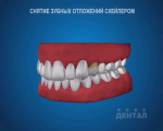 sna_Skaler
