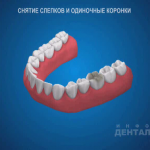 sna_Slepki_i_odinochnye_koronki