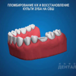 sna_Steklovolokno