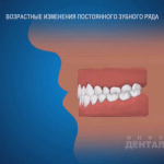 sna_Vozrastnye_izmenenia